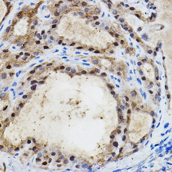 EPAS1/HIF2Alpha Rabbit Polyclonal Antibody - Image 2