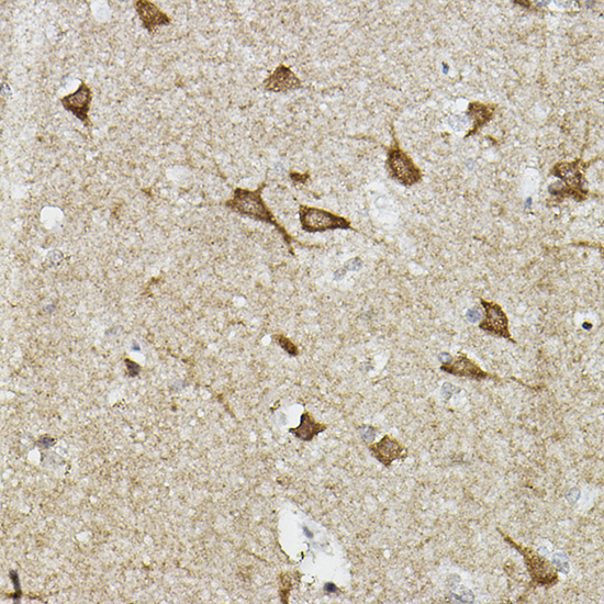EPAS1/HIF2Alpha Rabbit Polyclonal Antibody - Image 3