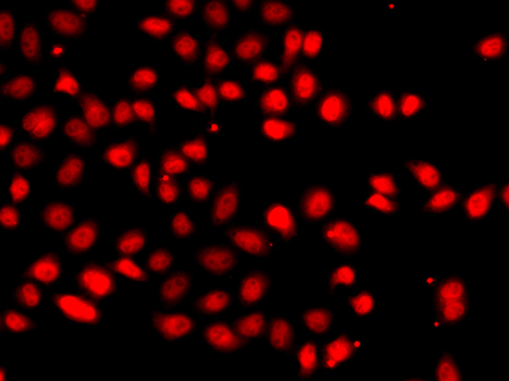 EPAS1/HIF2Alpha Rabbit Polyclonal Antibody - Image 4