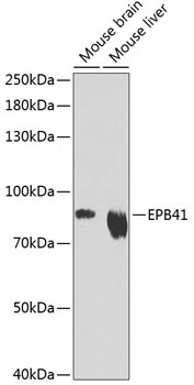 EPB41 Rabbit Polyclonal Antibody