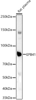 EPB41 Rabbit Polyclonal Antibody - Image 2