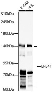 EPB41 Rabbit Polyclonal Antibody