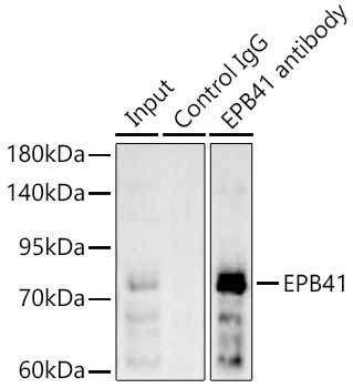 EPB41 Rabbit Polyclonal Antibody - Image 2