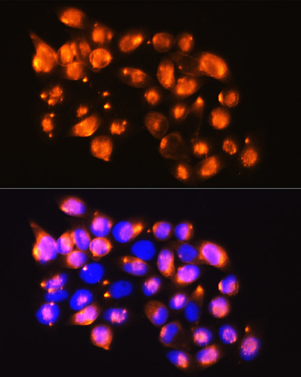 EPB41L2 Rabbit Polyclonal Antibody - Image 2