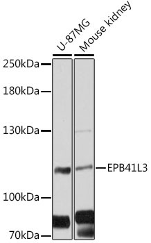 EPB41L3 Rabbit Polyclonal Antibody