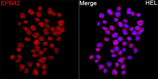 EPB42 Rabbit Polyclonal Antibody