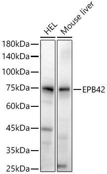 EPB42 Rabbit Polyclonal Antibody