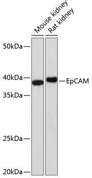 EpCAM Rabbit Monoclonal Antibody