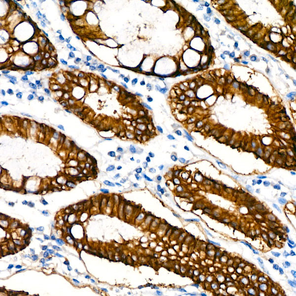EpCAM Rabbit Monoclonal Antibody - Image 3