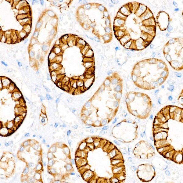 EpCAM Rabbit Monoclonal Antibody - Image 4