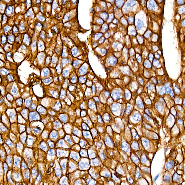 EpCAM Rabbit Monoclonal Antibody - Image 5