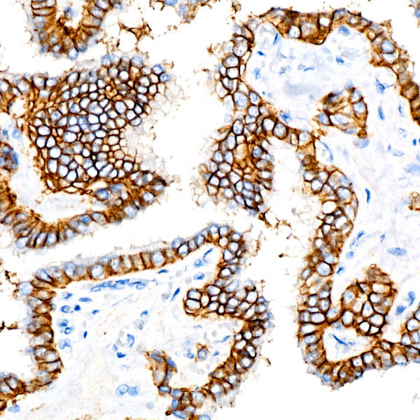 EpCAM Rabbit Monoclonal Antibody - Image 6