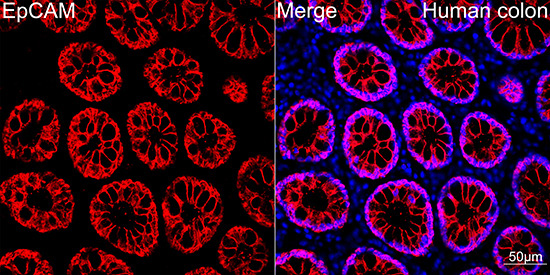 EpCAM Rabbit Monoclonal Antibody - Image 2