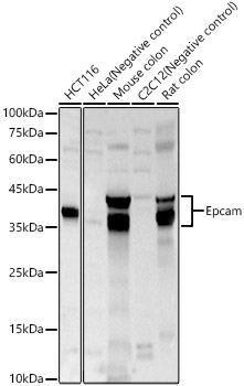 Epcam Rabbit Polyclonal Antibody