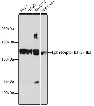 Eph receptor B3 (EPHB3) Rabbit Monoclonal Antibody