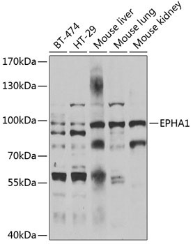 EPHA1 Rabbit Polyclonal Antibody