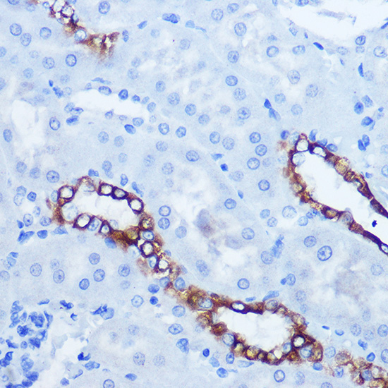 EPHA3/EPHA4/EPHA5 Polyclonal Antibody
