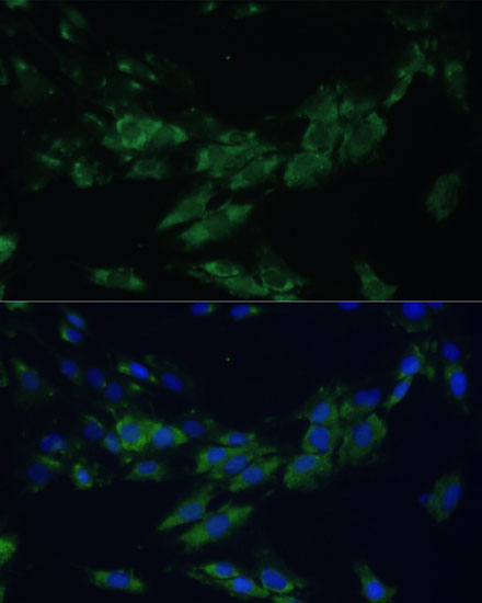 EPHA4 Rabbit Polyclonal Antibody - Image 2