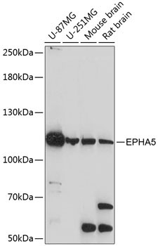 EPHA5 Rabbit Polyclonal Antibody