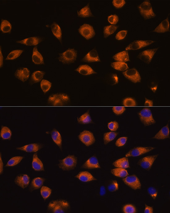 EPHA5 Rabbit Polyclonal Antibody - Image 2