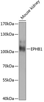 EPHB1 Rabbit Polyclonal Antibody