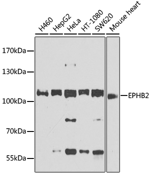 EPHB2 Rabbit Polyclonal Antibody