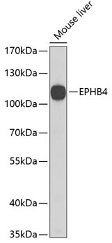 EPHB4 Rabbit Polyclonal Antibody