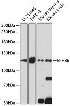 EPHB6 Rabbit Polyclonal Antibody