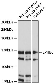 EPHB6 Rabbit Polyclonal Antibody