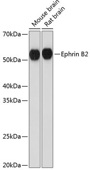 Ephrin B2 Rabbit Monoclonal Antibody
