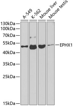 EPHX1 Rabbit Polyclonal Antibody