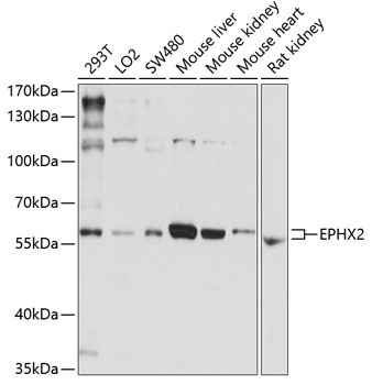 EPHX2 Rabbit Polyclonal Antibody