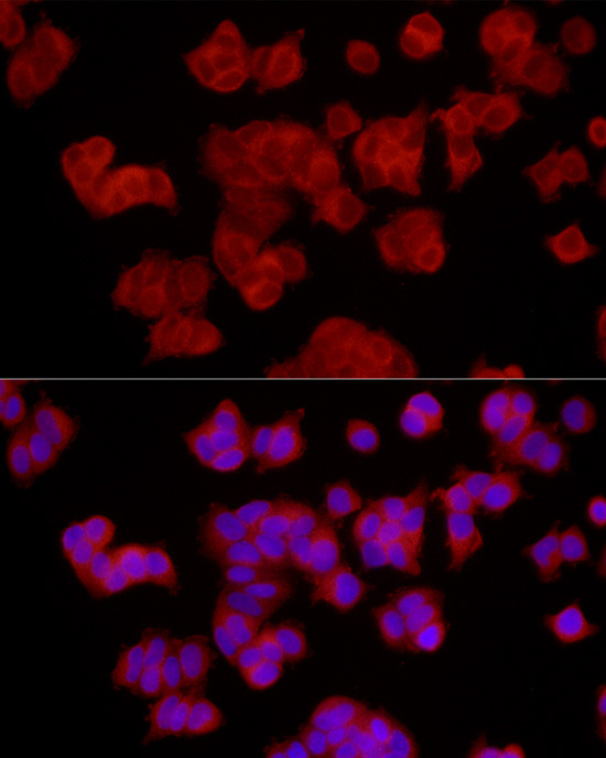 EPHX2 Rabbit Polyclonal Antibody - Image 2