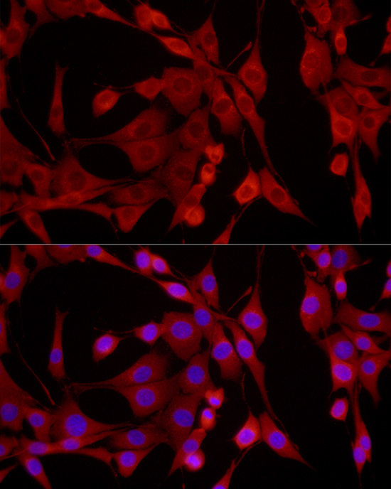 EPHX2 Rabbit Polyclonal Antibody - Image 3