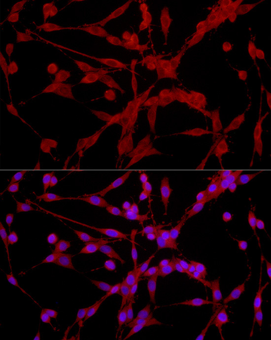 EPHX2 Rabbit Polyclonal Antibody - Image 4