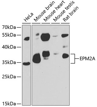 EPM2A Rabbit Polyclonal Antibody