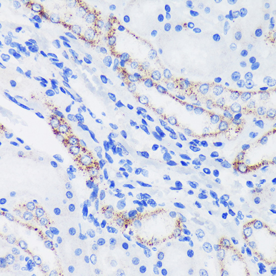 EPN1 Rabbit Polyclonal Antibody - Image 2