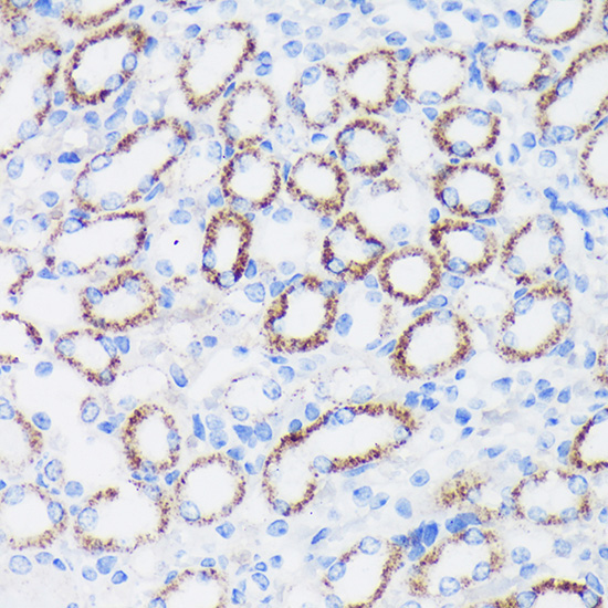 EPN1 Rabbit Polyclonal Antibody - Image 3