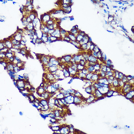 EPN2 Rabbit Polyclonal Antibody - Image 2