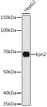 Epn2 Rabbit Polyclonal Antibody