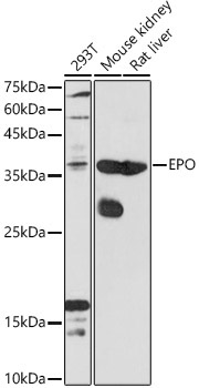 EPO Rabbit Polyclonal Antibody
