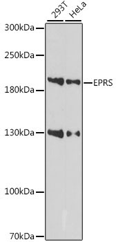 EPRS Rabbit Polyclonal Antibody