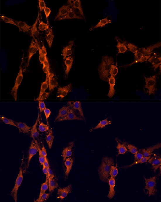 EPS15 Rabbit Polyclonal Antibody - Image 2