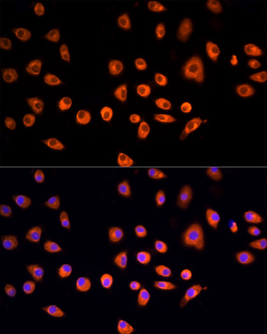 EPS15 Rabbit Polyclonal Antibody - Image 3