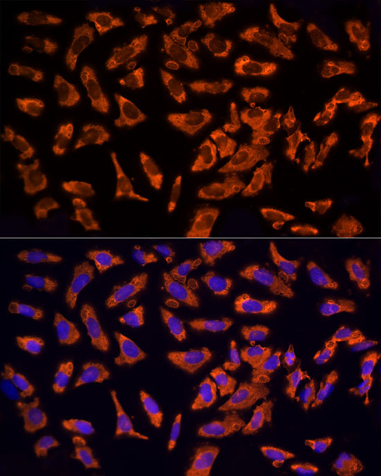 EPS15 Rabbit Polyclonal Antibody - Image 4