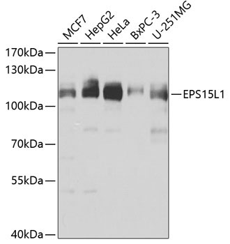 EPS15L1 Rabbit Polyclonal Antibody