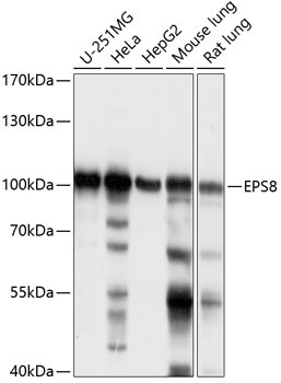 EPS8 Rabbit Polyclonal Antibody