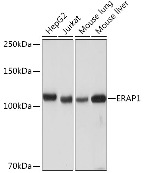 ERAP1 Rabbit Monoclonal Antibody