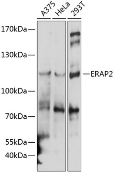 ERAP2 Rabbit Polyclonal Antibody