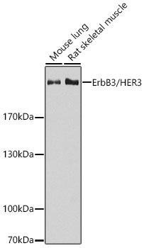 ErbB3/HER3 Rabbit Polyclonal Antibody